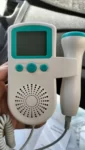 Fetal Doppler Heartbeat Monitor photo review