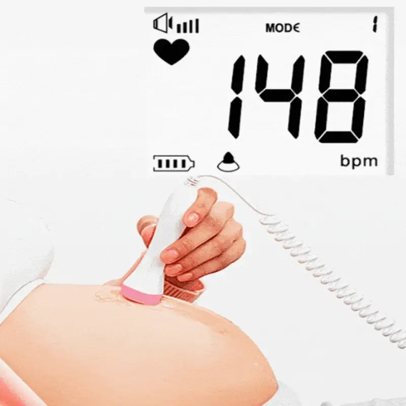 fetal doppler
